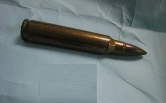 Incident neobișnuit - Un copil a fost lovit de un glonț rătăcit tras dintr-un poligon militar, în Coreea de Sud