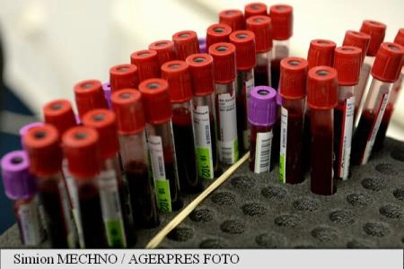 Test de sânge cu o acurateţe de 97% în diagnosticarea sclerozei laterale amiotrofice