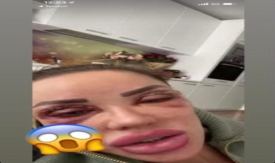 content-image