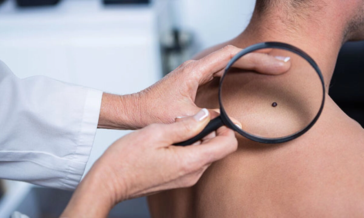 Peptidele combat pierderea fermităţii pielii