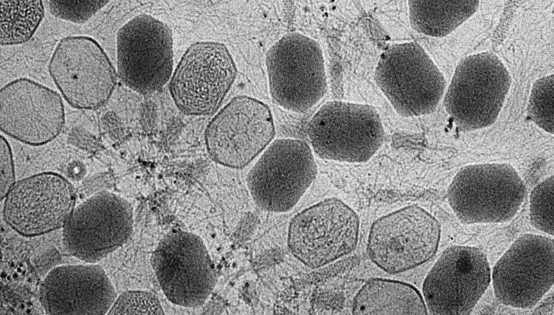 Descoperirea care rescrie biologia intestinului: 'Materia întunecată virală' - Sute de virusuri necunoscute, identificate de cercetători