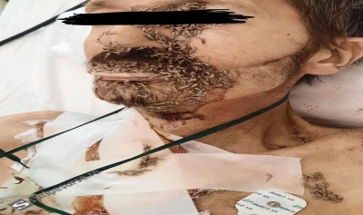 content-image