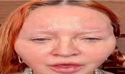 content-image