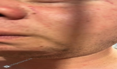 content-image