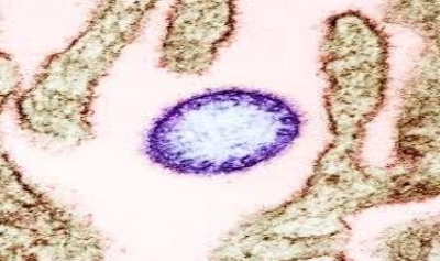 Article thumbnail