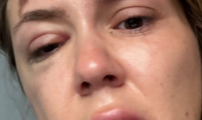 content-image