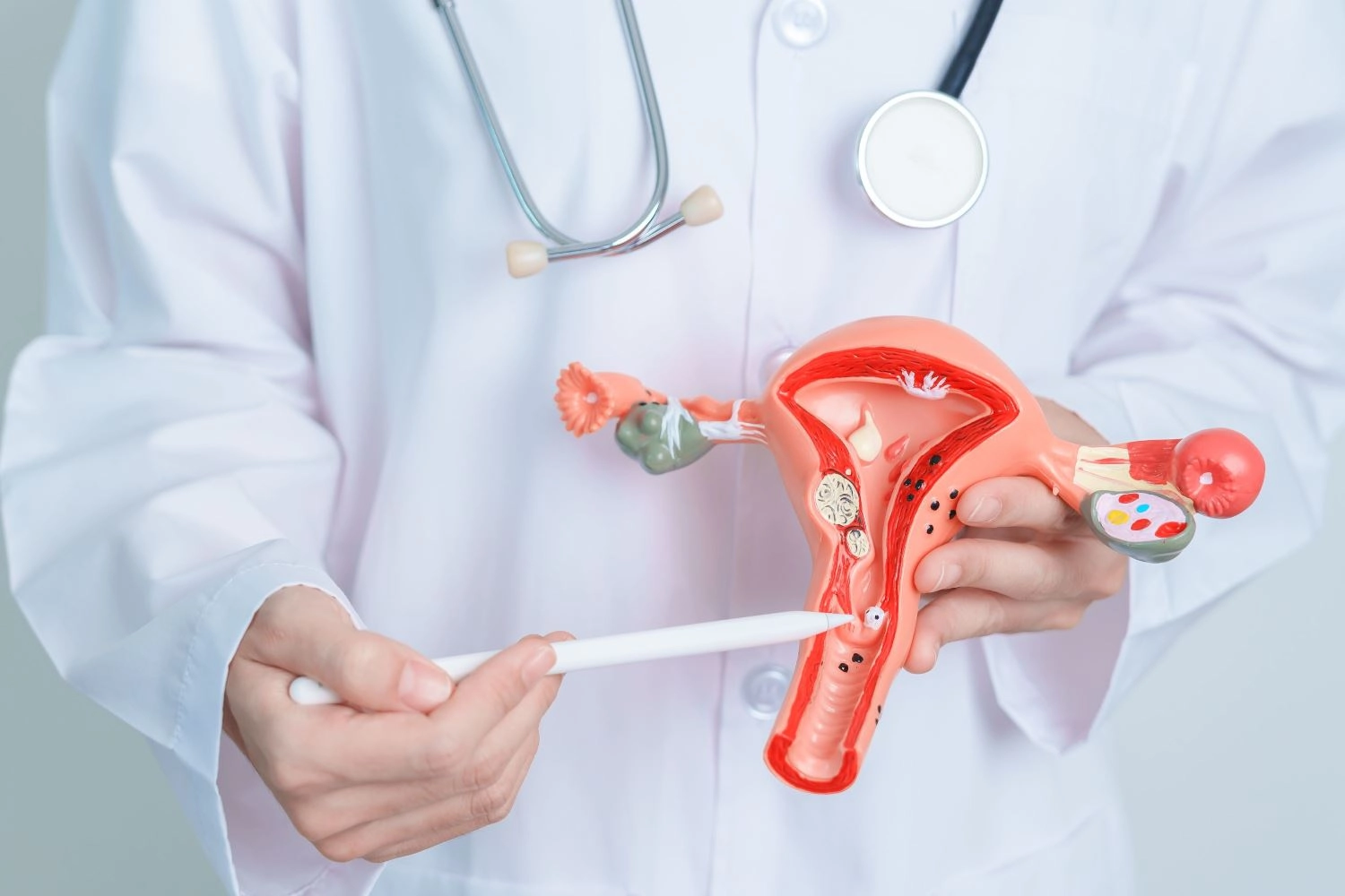 Mesaj de Ziua mondială a luptei împotriva cancerului: vaccinarea anti-HPV, esențială în prevenția cancerului de col