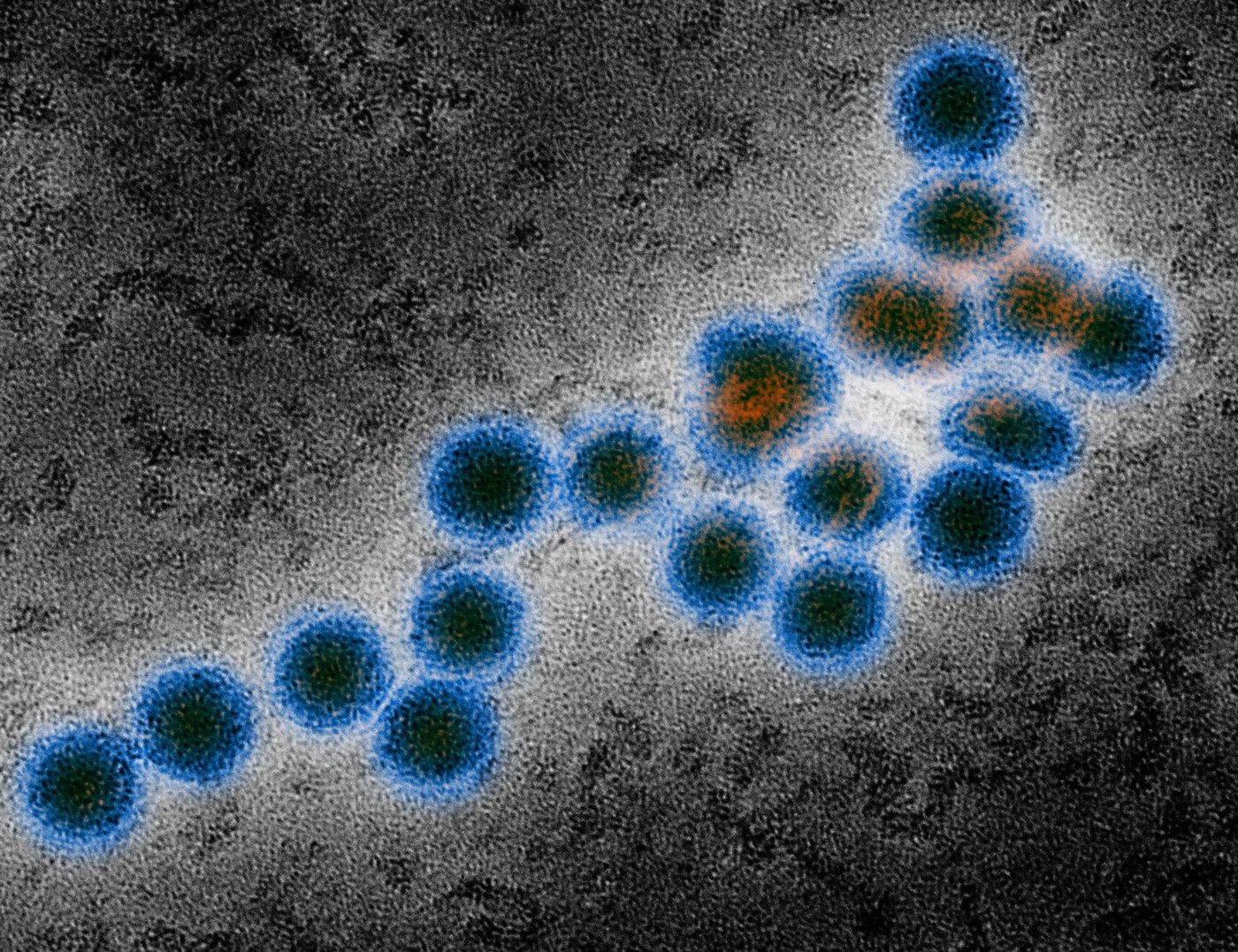 21 de cazuri de infecţie cu virusul West Nile, înregistrate de la începutul lunii iunie, potrivit INSP