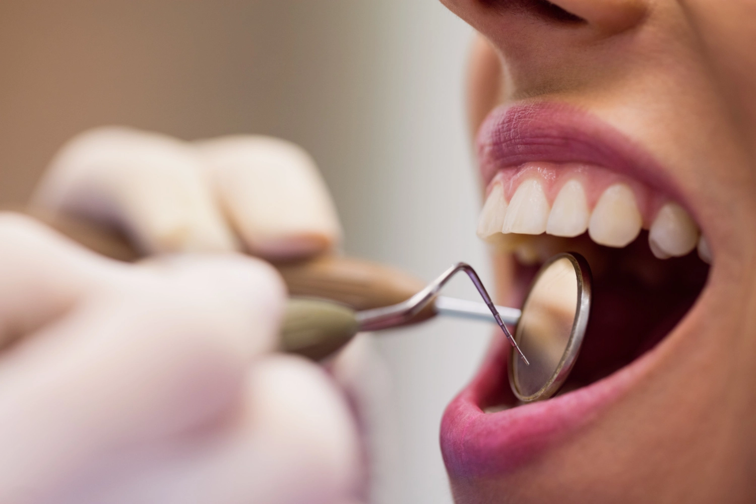 Hipnoza, soluție împotriva fricii de dentist. Medicul Lorelei Nassar explică: 'Pacienții sunt pe deplin în control asupra întregului proces'