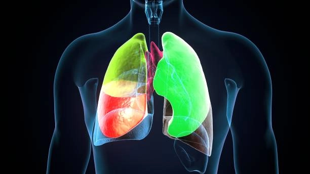 Cum poate trăi un om fără plămâni? Un organ artificial a făcut posibil imposibilul