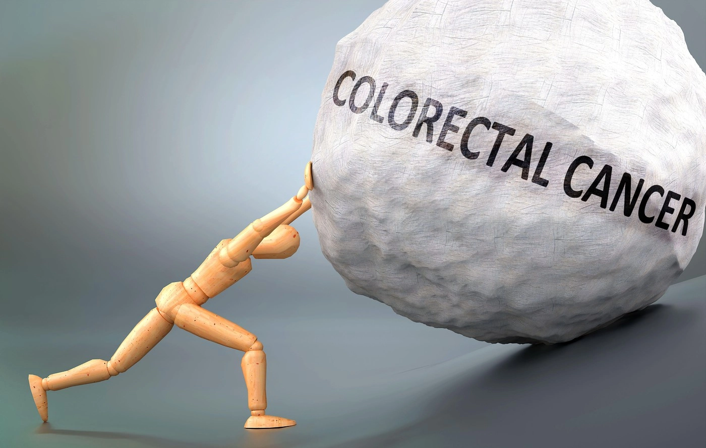 Incidența cancerului colorectal crește rapid la sub 50 de ani. Cauzele rămân un mister