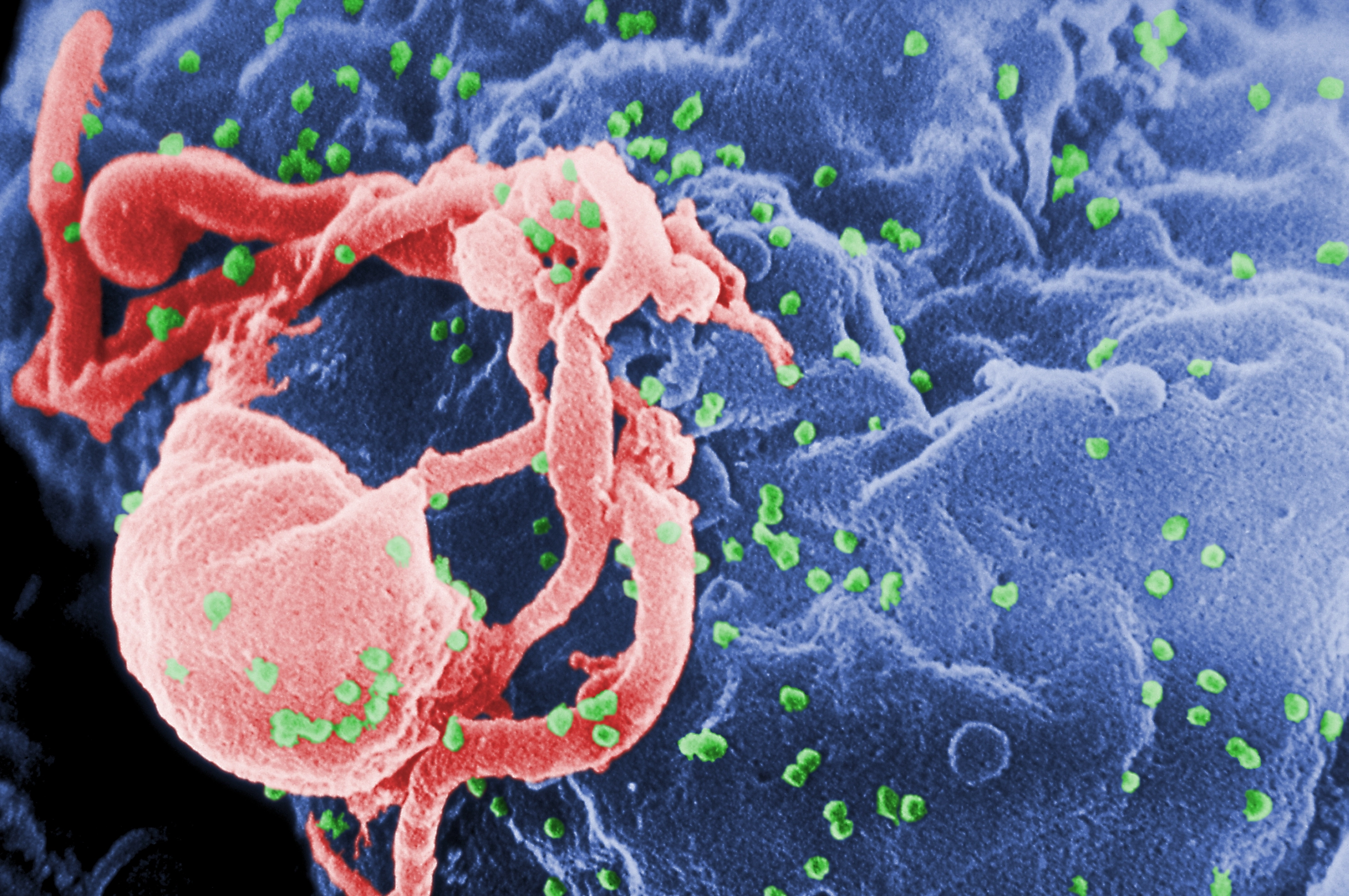Descoperire revoluționară în prevenția HIV: un tratament va fi disponibil în peste 100 de țări