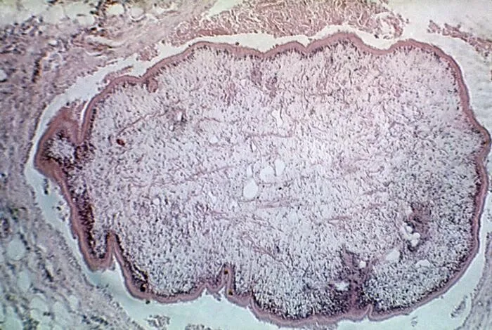 Sparganum_proliferum