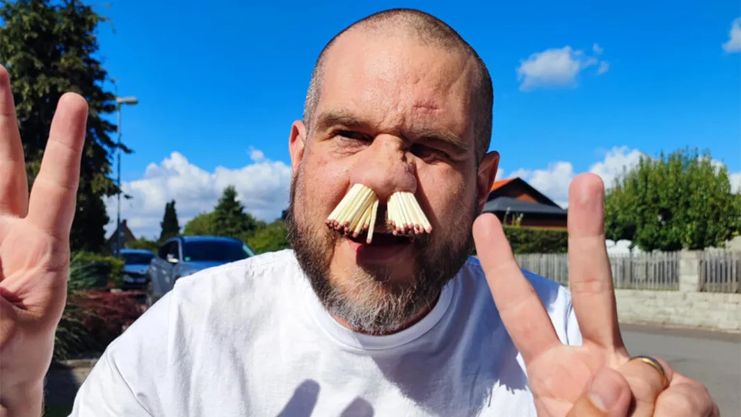 most-matches-in-nose-header-thumbnail