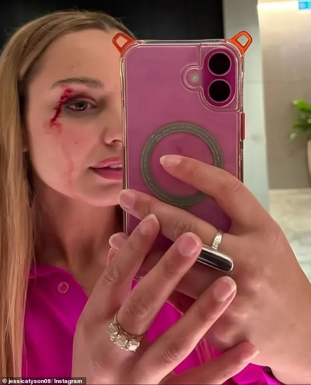 reporteriță pescăruș